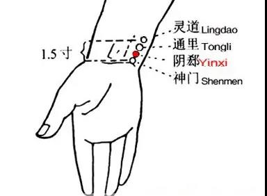 睡覺愛出汗，艾灸這幾個(gè)穴位